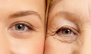 بهترین کرم دور چشم برای جوانسازی + قیمت