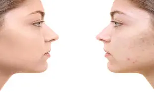5 کرم ضدجوش صورت با قیمت زیر 300 هزار تومان