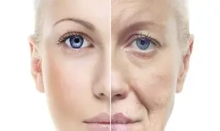 مؤثرترین کرم ضدچروک برای سنین بالای 40 سال