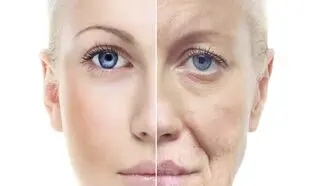 مؤثرترین کرم ضدچروک برای سنین بالای 40 سال