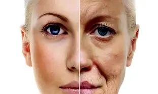 مؤثرترین کرم ضدچروک برای سنین بالای 40 سال