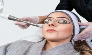 تمام قابلیت‌ های دستگاه لیزر پیکوسکند؛  از پاک کردن تتو تا رفع لکه های پوستی