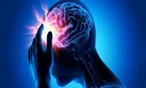 آمار شوکه کننده سکته مغزی در کشور
