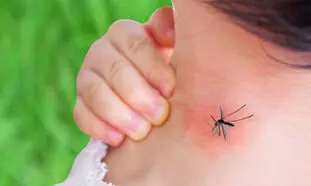 تب دنگی چه تاثیری بر کودکان دارد؟ + شیوه درمان