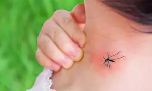 تب دنگی چه تاثیری بر کودکان دارد؟ + شیوه درمان