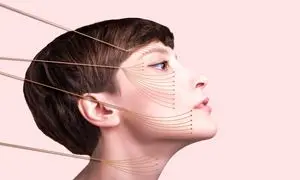 بهترین دکتر لیفت صورت با نخ در اصفهان کیست؟