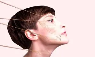 بهترین دکتر لیفت صورت با نخ در اصفهان کیست؟