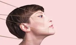 بهترین دکتر لیفت صورت با نخ در اصفهان کیست؟