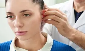 جراحی زیبایی گوش چیست؟ معرفی عوارض و تاثیر عمل گوش در زیبایی