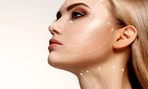 لیفت صورت با جراحی چقدر ماندگاری دارد؟