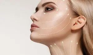 لیفت صورت با جراحی چقدر ماندگاری دارد؟