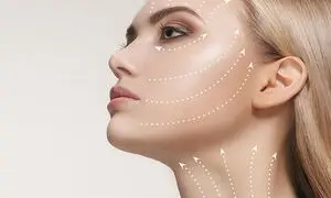 لیفت صورت با جراحی چقدر ماندگاری دارد؟