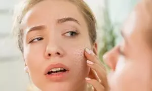 ترمیم پوست خود را به الارو بسپارید