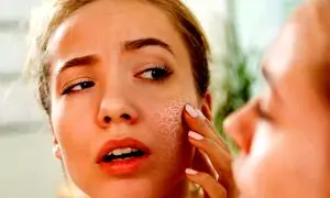 ترمیم پوست خود را به الارو بسپارید