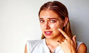 با این شوینده‌، پوستتان را از شر چربی اضافه و جوش نجات دهید!