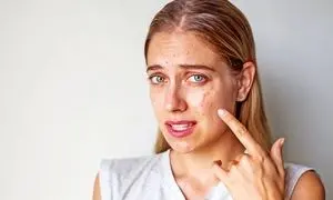 با این شوینده‌، پوستتان را از شر چربی اضافه و جوش نجات دهید!