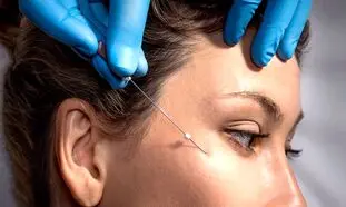 بهترین کلینیک لیفت صورت با نخ در اصفهان کدام است؟