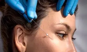بهترین کلینیک لیفت صورت با نخ در اصفهان کدام است؟