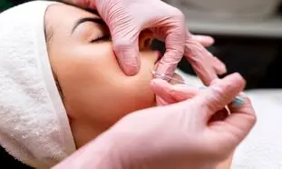 مزایای لیفت صورت با نخ کدام است؟