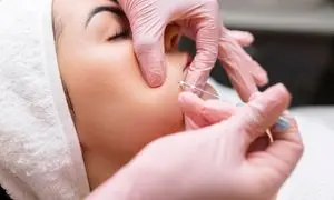 مزایای لیفت صورت با نخ کدام است؟