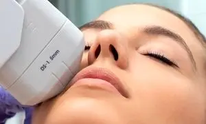 ۳ مزیت هایفوتراپی برای پوست صورت