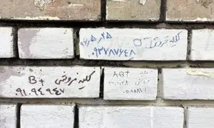 خرید و فروش کلیه در بازاری دردناک با کف قیمت 80 میلیون