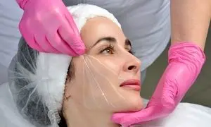 بهترین مرکز لیفت صورت با نخ در اصفهان؛ مراقبت ها و عوارض