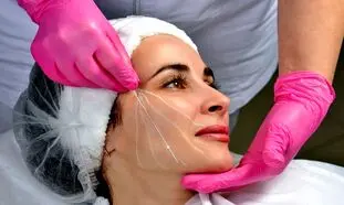 برای لیفت صورت با نخ در شاهین شهر به کدام کلینیک مراجعه کنیم؟