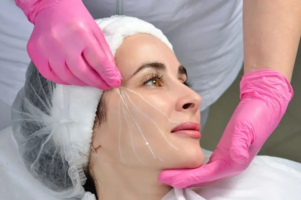 برای لیفت صورت با نخ در شاهین شهر به کدام کلینیک مراجعه کنیم؟