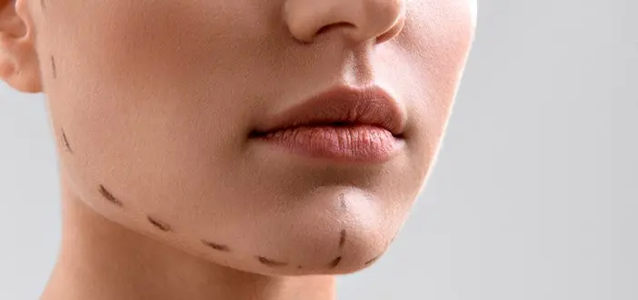 جراحی چانه چه قدر در زیبایی دختران جوان اثرگذار است؟