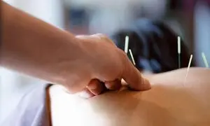 بهترین کلینیک برای کاشت نخ لاغری در اصفهان کدام است؟