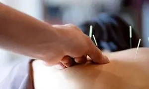 بهترین کلینیک برای کاشت نخ لاغری در اصفهان کدام است؟