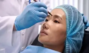 بهترین مرکز لیفت صورت در اصفهان؛ ویژگی‌ها و مزایا