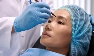 بهترین مرکز لیفت صورت در اصفهان؛ ویژگی‌ها و مزایا